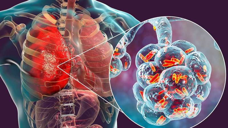  Hovuz və kondisionerlər vasitəsi ilə dəhşətli virus yayılır